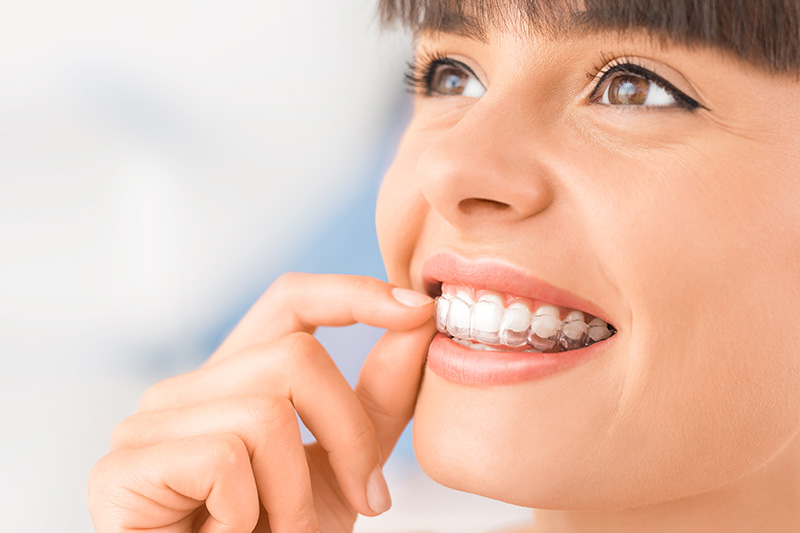 Invisalign in Berwyn